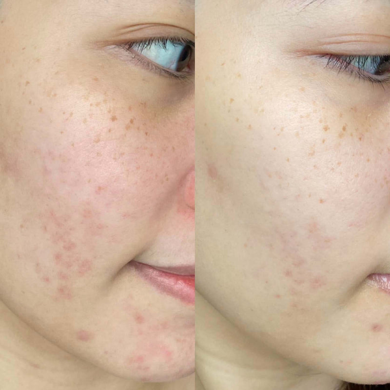 New Age™ products | Review by pimwimon
